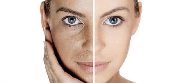 چہرے کی جلد کو پھر سے جوان کرنے سے پہلے اور بعد میں